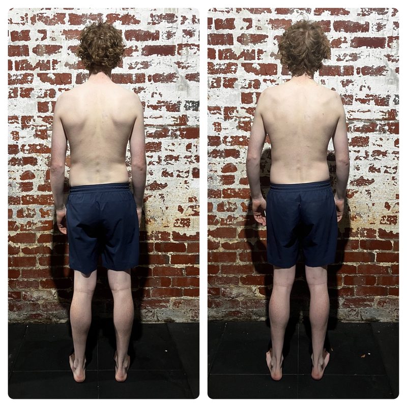 Charlie posture before and after Functional Patterns training