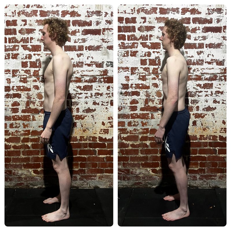 Charlie posture before and after Functional Patterns training