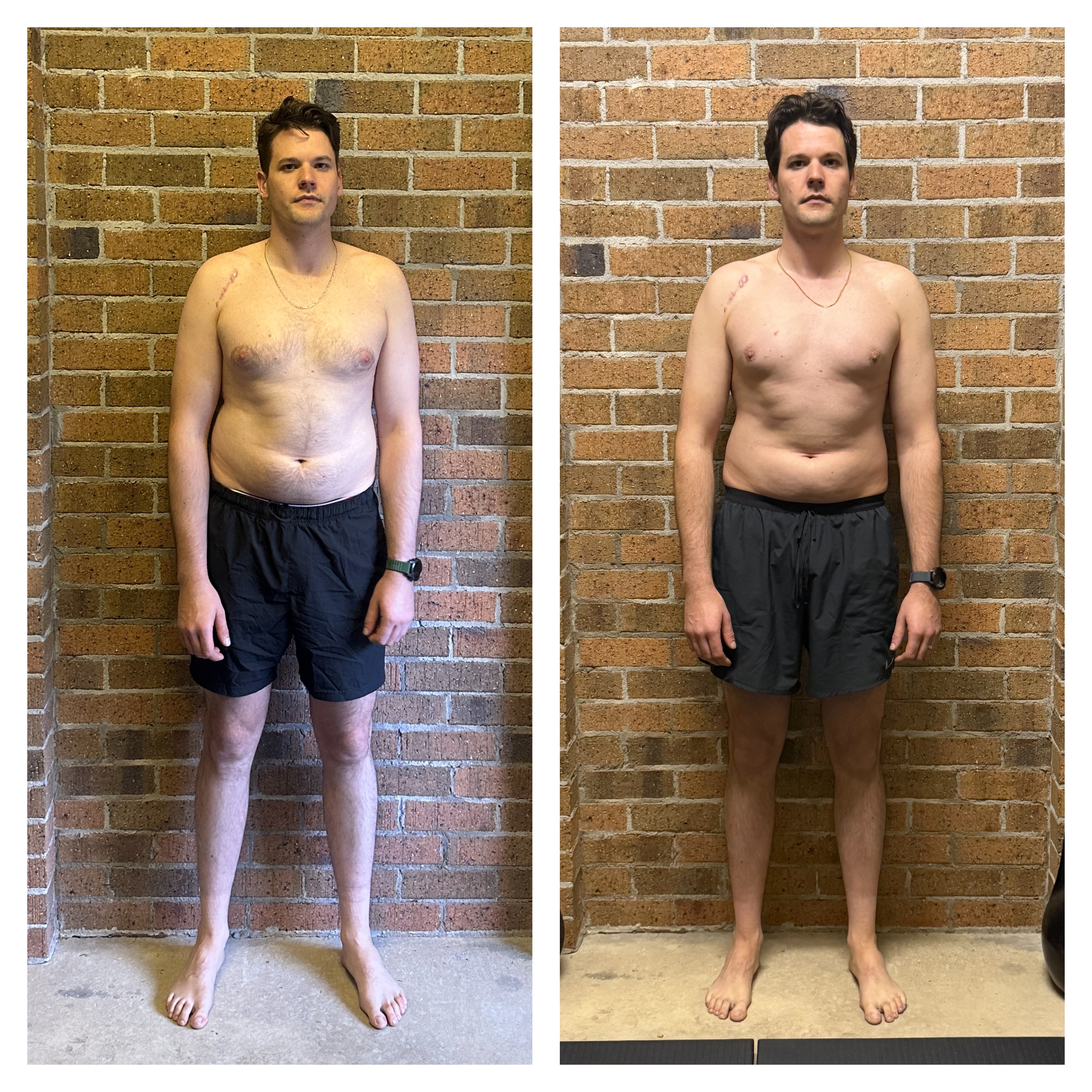 Taras posture before and after Functional Patterns training